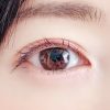 健診でまぶたの裏を調べるのは何のため？　医師が回答