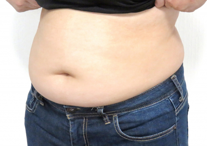 コロナ重症化リスクを高める肥満度「BMI」数値と計算方法　医師が解説