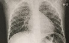 肺を鍛えるとすべてが変わる……コロナ禍で重要な肺と免疫力の関係性を医師が解説