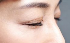 宮根誠司さんが治療した「眼瞼下垂」