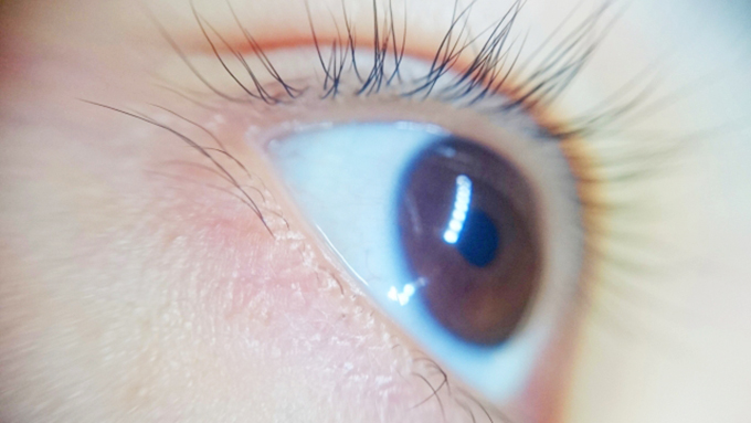 完治する治療法がない「網膜色素変性症」　～IT機器によって低視力を補う