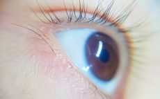 完治する治療法がない「網膜色素変性症」　～IT機器によって低視力を補う