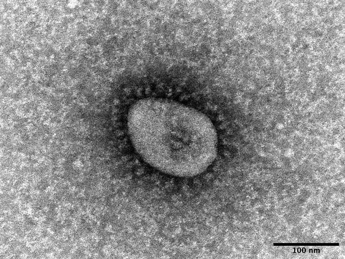 オミクロン変異株『BA.5』は「感染力がより強くなった」　医師が解説する流行するウイルスの条件