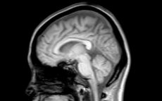 40歳を過ぎたら、5年に1度は「脳ドック」を受ける　～脳の病気を防ぐために