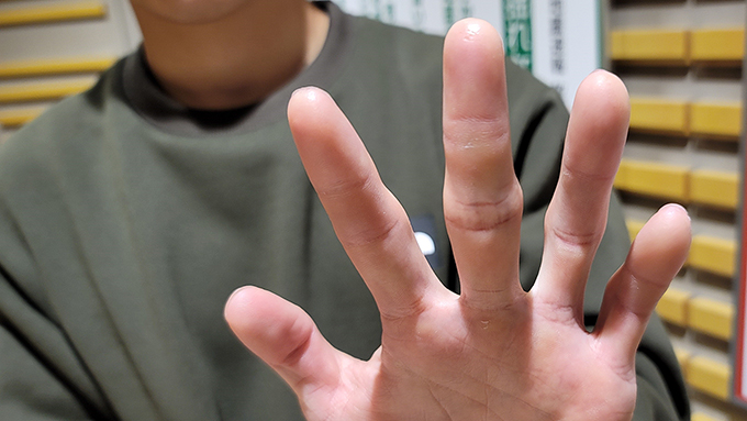 スポーツクライミング「スピード」日本記録保持者・大政涼の手には指紋がない！？