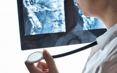 胃がん検査の「X線検査」と「内視鏡検査」のメリットとデメリットを専門医が解説
