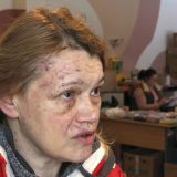ミサイルによる爆風が襲った瞬間を振り返るオレナ・コシノワさん。顔にはいくつもの傷が残っていた＝2024年1月13日、キーウ（共同）